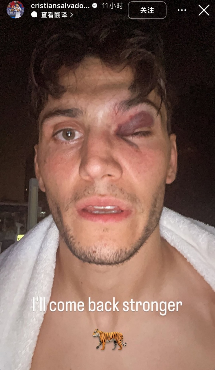 津門(mén)虎外援薩爾瓦多曬眼部受傷照：會(huì )以更強大的姿態(tài)歸來(lái)